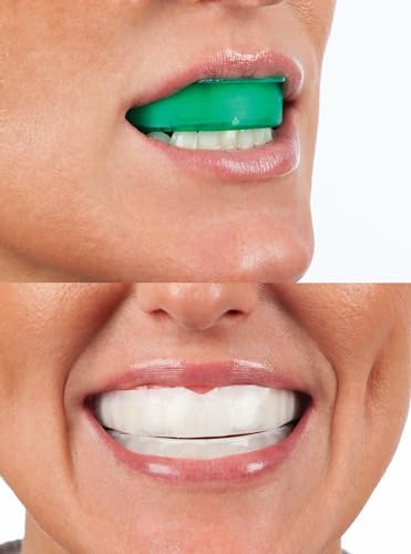 Opalescence Go - Prefilled Teeth Whitening Trays - Original 15% - (4 Treatments) - Hydrogen Peroxide with PF - Cool Mint - Made by Ultradent. 4648-1