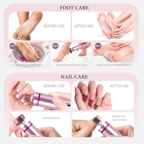 Ranrose 2-in-1 Electric Foot Callus Remover - 9-Speed Dead Skin Removal for Feet, Cordless Pedicure Foot File with LED Display, Fast Charging for Home Foot & Nail Care