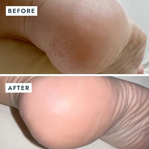 VOESH Solemate Heel Repair Balm, Heel Moisturizer & Repair, Balm for Rough and Cracked Heels, Foot Care