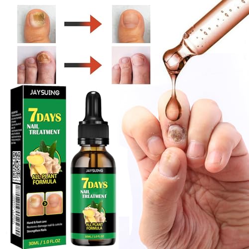 Ginger Nail Treatment Nail Support Nail Care, 7days Nail Treatment, Ginger Nail Growth Serum, Ginger Cuticle Care Oil for Nails,Cuticle Serum for Nails (3Pcs, 1 Fl.oz(pack of 1))