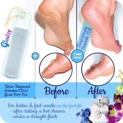 GLADZY Czech Glass Nail File Set - Multifunctional Nail Shiner Buffer, Callus Remover Foot Rasp, Glass Cuticle Pusher Manicure Stick, Etched Surface, Professional Nail Care Tool, Made in EU