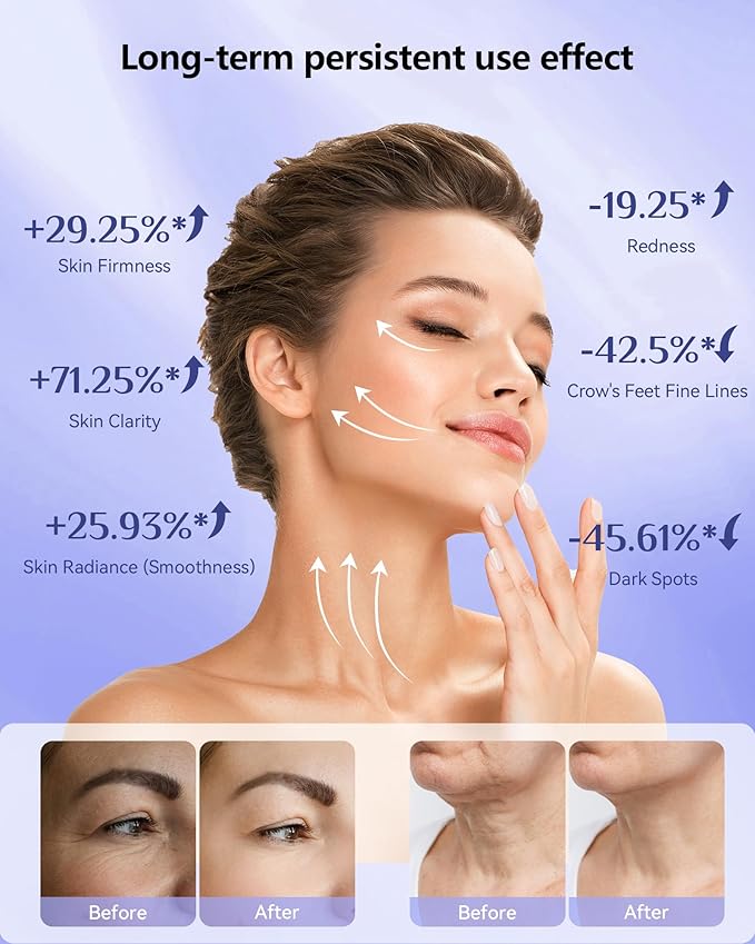 Red Light Therapy for Face,LED Face Mask Light Therapy, 630nm & 830nm Wavelength LED Light Therapy Device for Home Use (Satin Black)
