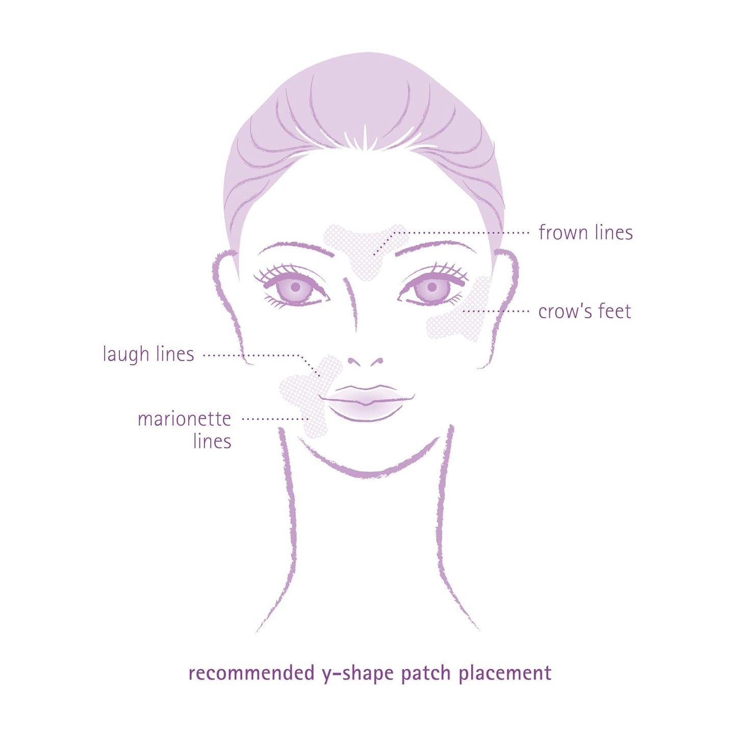 Toute Nuit Wrinkle Patches – Y Shape – Face Tape for Forehead, Between the Eyes & Around Mouth – Hypoallergenic Anti Wrinkle Patches – 20 Count, Made in USA