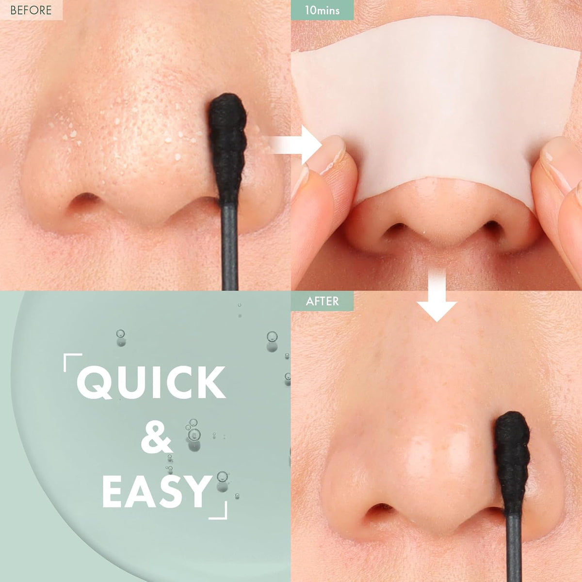 Blackhead Melting Clear with Witch Hazel is ideal for K-beauty routines, effectively removing blackheads , Sebum Control and unclogging pores, 55ml, 1.85 fl. oz.