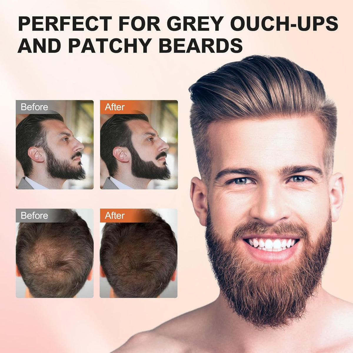 Root Touch Up Hair Powder, Instantly Root Cover Up Hairline Shadow Powder,Hairline Powde for Women Eyebrows, Gray Hair Coverage Touch Up For Men Beard Line,Bald Spots (Light Brown)