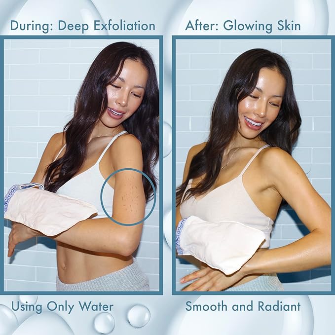 MicrodermaMitt Deep Exfoliating Mitt for Shower - Premium Dead Skin Remover & Exfoliator Body Scrubber - Turkish Kese Glove for Keratosis Pilaris - Natural Skin Care for Smooth, Radiant Results