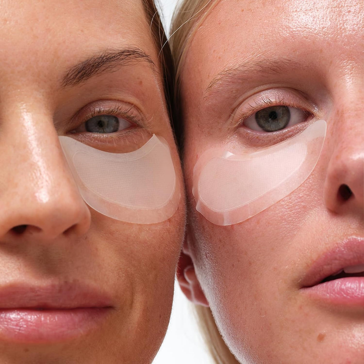 skyn ICELAND Dissolving Microneedle Under Eye Patches with 39% Hyaluronic Acid and Peptides, No Slip Overnight Eye Mask for Fine Lines, Wrinkles and Firming, Vegan, All Skin Types, 5 Pairs