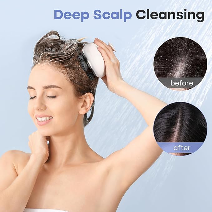 arboleaf Scalp Massager Electric Kneading Head Massager Scalp Stress Relax Portable Rechargeable Hair Massage Waterproof Cat Scratcher, Gifts for Him Her
