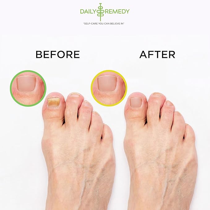 DAILY REMEDY 4-Pack Foot Soak Set - 2 Extra Strength Tea Tree Oil & 2 Citrus Detox - Made In USA - Soothes Sore Tired Feet, Athletes Foot, Stubborn Foot Odor, Softens Calluses & Refreshes & Detoxifies
