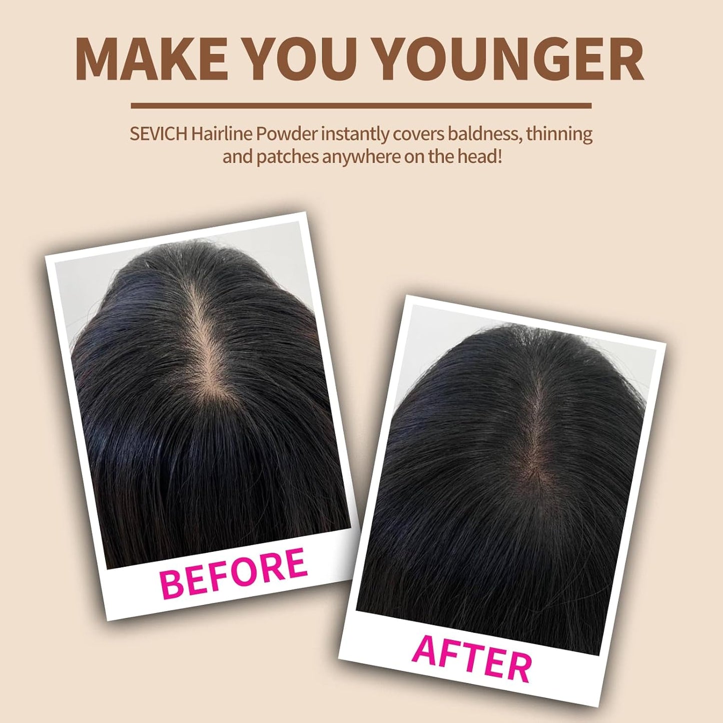 SEVICH Hairline Powder - Instantly Cover Grey Hair and Thinning Hairline, Eyebrows & Beard Line Touch Up, Windproof & Sweatproof, Auburn