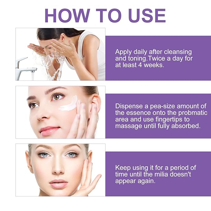 Milia Remover Cream for Eyes & Face,Milia Spot Treatment with Salicylic Acid,Milia Acne Cream