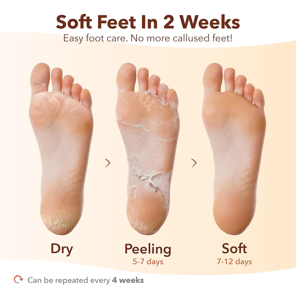 Purederm Exfoliating Foot Mask (3 Pack) – Regular Size Exfoliating Foot Masks for Cracked Feet, Dry Skin, Callused Feet…