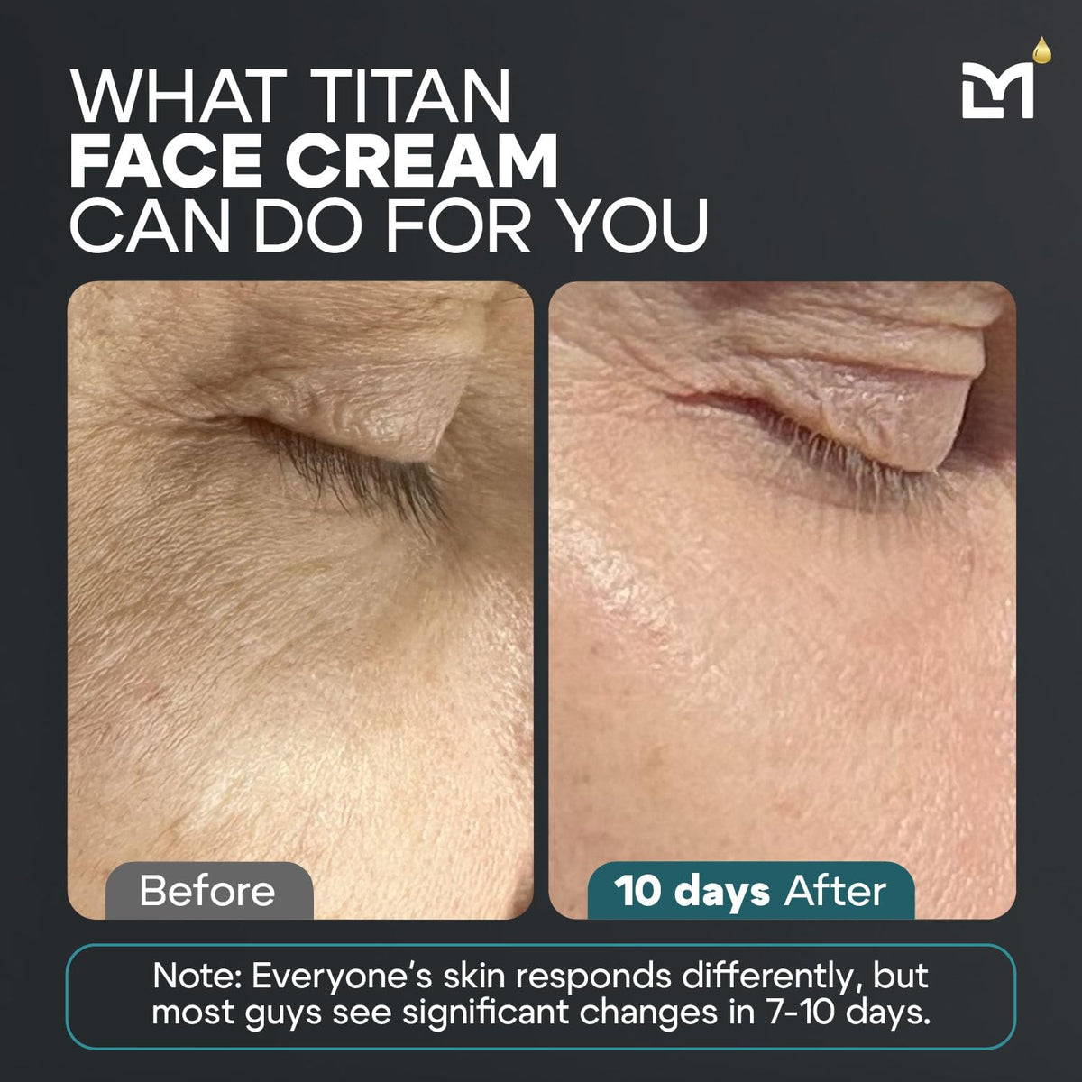 Titan Peptide Anti-Aging Mens Face Cream – Mens Face Moisturizer – For Men, Face Lotion – Men, Skin Care – Tighten, Firm, Revitalize – Peptides, Vitamin C & E, Squalane – All Skin – Unscented
