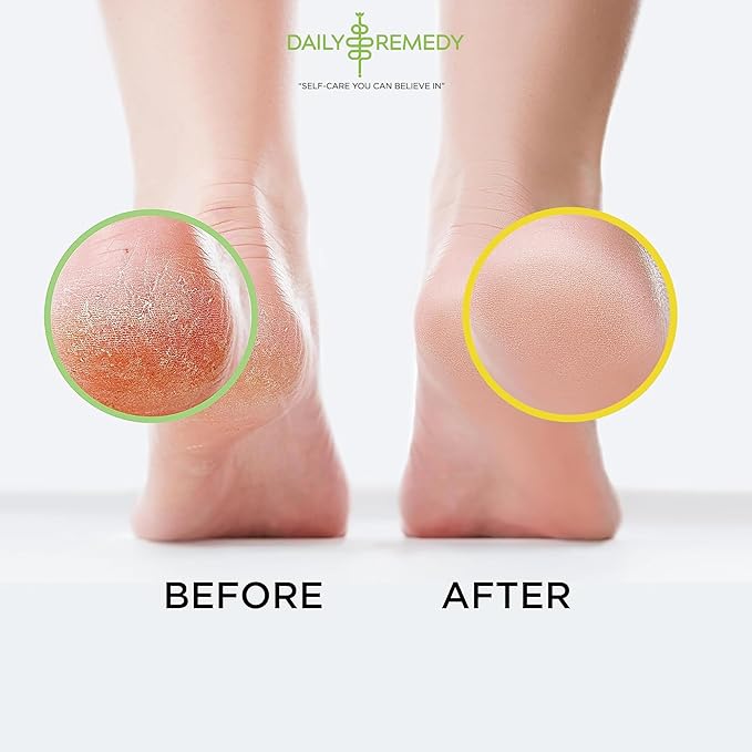 DAILY REMEDY 4-Pack Foot Soak Set - 2 Extra Strength Tea Tree Oil & 2 Citrus Detox - Made In USA - Soothes Sore Tired Feet, Athletes Foot, Stubborn Foot Odor, Softens Calluses & Refreshes & Detoxifies