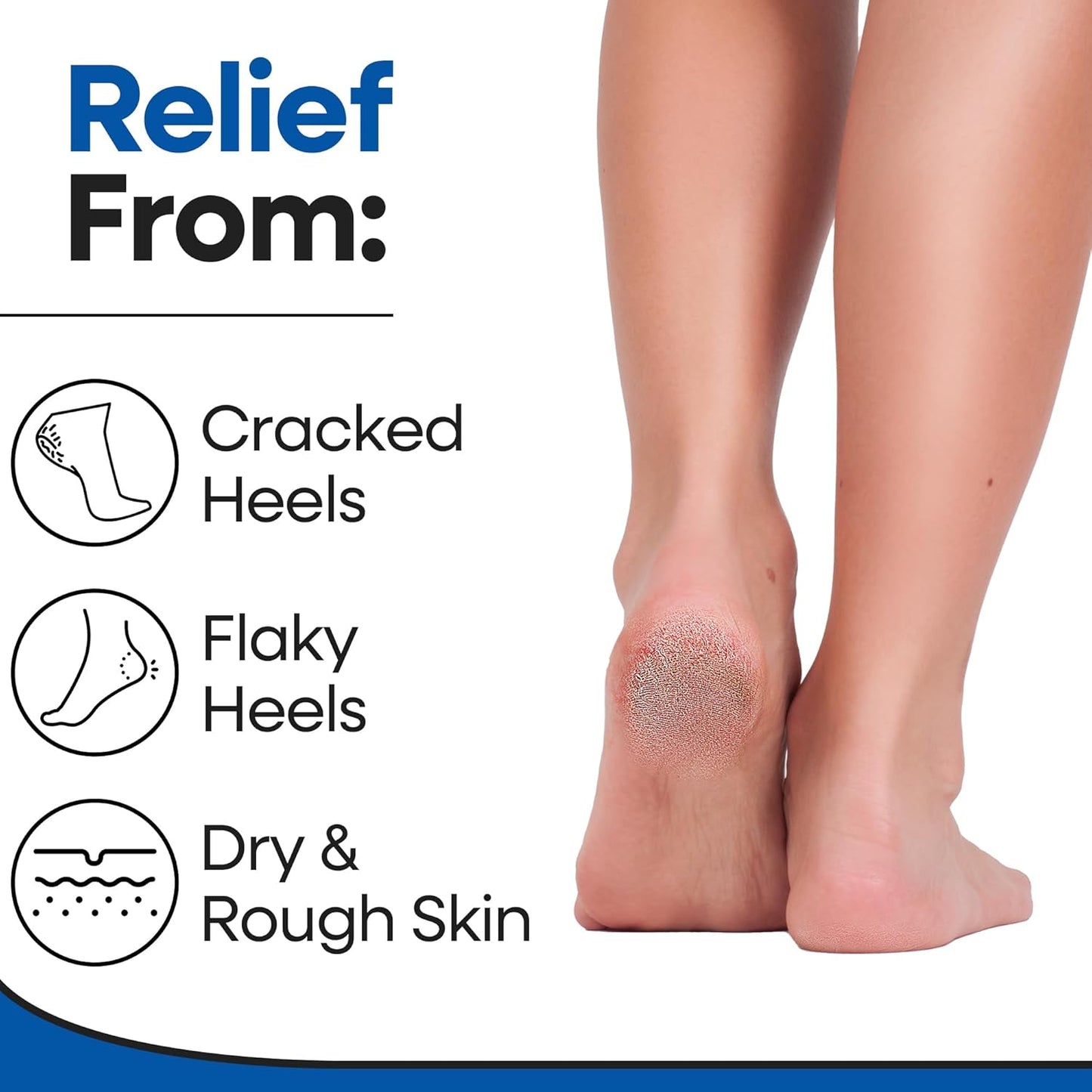 Moisturizing Socks for Mens Cracked Heels - Moisturizer Heel Sleeves to Smooth & Soften Rough Cracked Heels & Dry Feet. Large Aloe Moisturizing Heel Socks (White - 3 Pairs, X-Large)