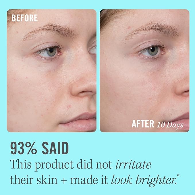 First Aid Beauty - 10% Vitamin C Brightening Serum, Daily Dark Spot Serum with Squalane & Vitamin E, Helps Brighten Without Irritation or Clogged Pores, Safe for Sensitive Skin, 1.7 oz