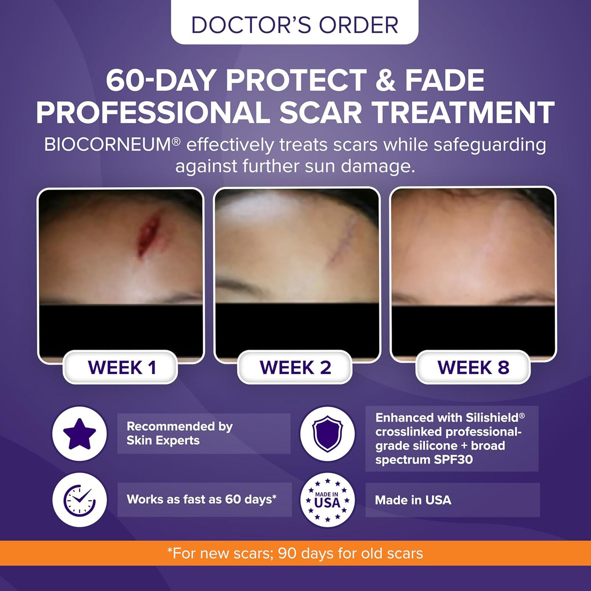 Advanced Scar Treatment with Silishield® & SPF 30 50g – Made in the USA, Fast-Drying, Water-Resistant Silicone Scar Gel - Surgeon Recommended for New & Old Scars - Suitable for Children Over 6 Months
