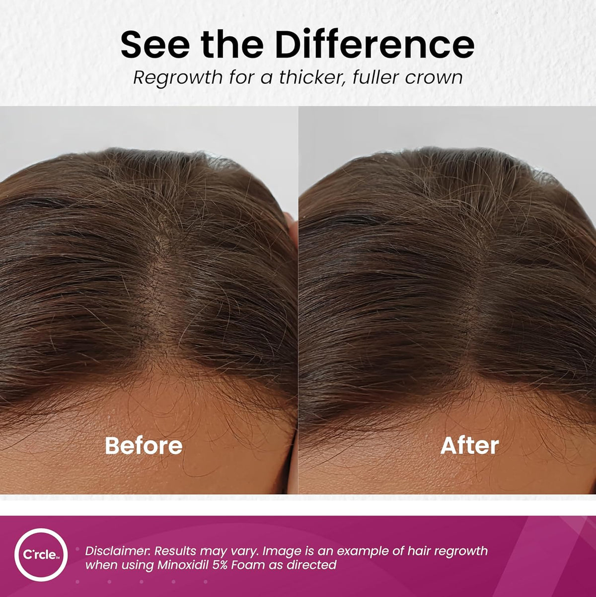 C'rcle Minoxidil for Women 5% Foam - Helps Restore Top of Scalp Hair Loss and Support Hair Growth for Women, Regrowth with Unscented Topical Treatment for Thinning Hair (5% Foam 8-Month Supply)